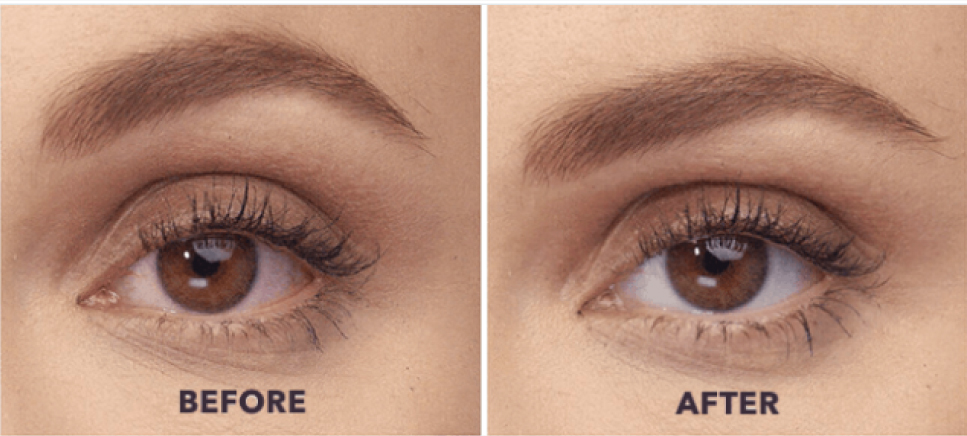 eye_compare1